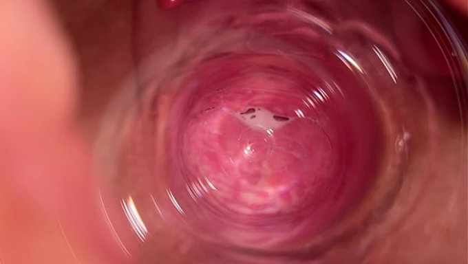 A Camera Was Stuck Inside The Wet Pussy Of Mia