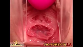 Gynocam Cl...